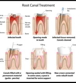 Smile Plus Dental Clinic